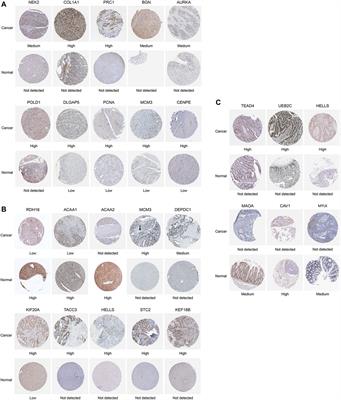 Leader gene identification for digestive system cancers based on human subcellular location and cancer-related characteristics in protein–protein interaction networks